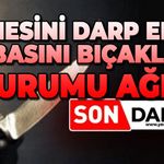 Annesini darp eden babasını bıçakladı: Durumu ağır