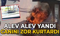 Alev alev yandı canını zor kurtardı