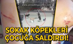 Sokak köpekleri çocuğa saldırdı!