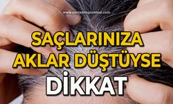 Saçlarınıza aklar düştüyse dikkat 