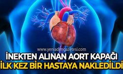 İnekten alınan aort kapağı ilk kez bir hastaya nakledildi