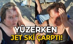 Yüzerken jet ski çarptı!