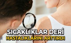 Sıcaklıklar deri hastalıklarını arttırdı