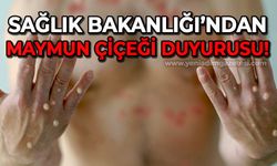 Sağlık Bakanlığı'ndan "Maymun Çiçeği" duyurusu!