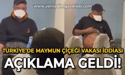 Türkiye'de maymun çiçeği vakası iddiası: Açıklama geldi!