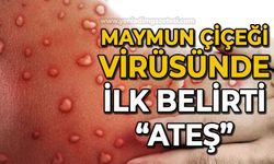 Maymun Çiçeği virüsünde ilk belirti ateş