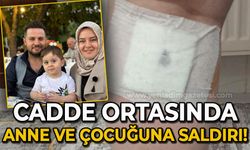 Sokak köpekleri anne ve oğluna saldırdı