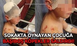 Sokakta oynayan çocuğa başıboş köpek saldırdı