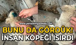 Bunu da gördük: İnsan köpeği ısırdı