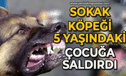 Sokak köpeği 5 yaşındaki çocuğa saldırdı