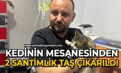 Mesanesinden 2 santimlik taş çıkarıldı