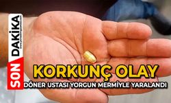 Korkunç olay: Döner ustası yorgun mermiyle yaralandı