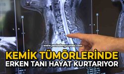 "Kemik tümörlerinde erken tanı hayat kurtarıyor"