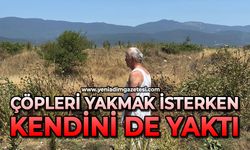 Çöpleri yakmak isterken kendini de yaktı