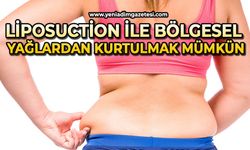 "Liposuction ile bölgesel yağlardan kurtulmak mümkün"