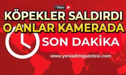 Köpeklerin saldırısına uğradı: O anlar kamerada