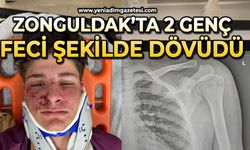Zonguldak’ta 2 genç feci şekilde dövüldü
