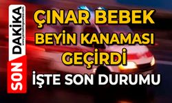 Beyin kanaması geçiren Çınar bebek doktorun hızlı müdahalesiyle şifa buldu
