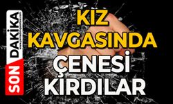 ‘Kız kavgasında’ çenesi kırdılar