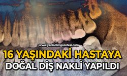 16 yaşındaki hastaya doğal diş nakli yapıldı