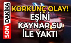 Korkunç olay: Eşini kaynar suyla yaktı