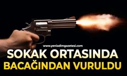 Sokak ortasında bacağından vuruldu