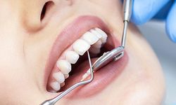 Ağızdaki sessiz düşman: Kalpten beyne kadar yayılıyor