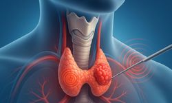 'Hızlı büyüyen tiroid nodüllerinde cerrahi müdahale gerekebilir'