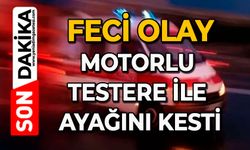 Feci olay: Motorlu testere ile ayağını kesti