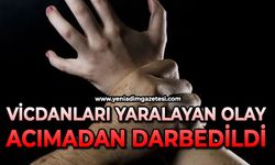 Vicdanları yaralayan olay: Odunla darbedildi