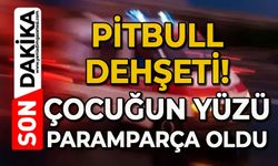 Pitbull dehşeti: Çocuğun yüzü paramparça oldu