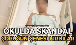 Okulda skandal: 15 yaşındaki öğrencinin çenesi kırdılar