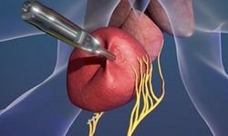 'Prostat büyümesinde HoLEP ile kesi olmadan iyileşmek mümkün'