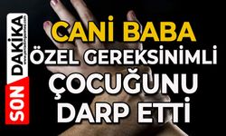 Cani baba özel gereksinimli çocuğunu darp etti