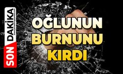 Oğlunun burnunu kırdı