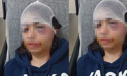Ayrılık kararını kabullenemeyip kız arkadaşını darp etmişti: 'Pişmanım'