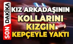 Kız arkadaşının kollarını kızgın kepçeyle yaktı