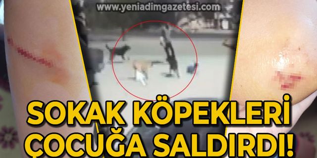Sokak köpekleri çocuğa saldırdı!