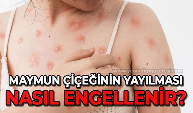 Maymun çiçeğinin yayılması nasıl engellenir?