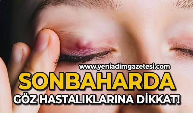 Sonbaharda göz hastalıklarına dikkat!