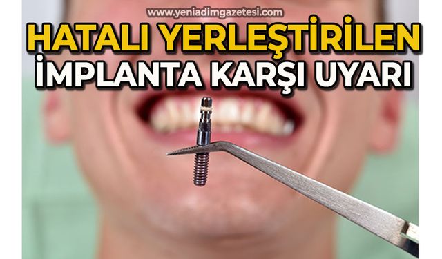 Hatalı yerleştirilen implanta karşı uzmanı uyardı