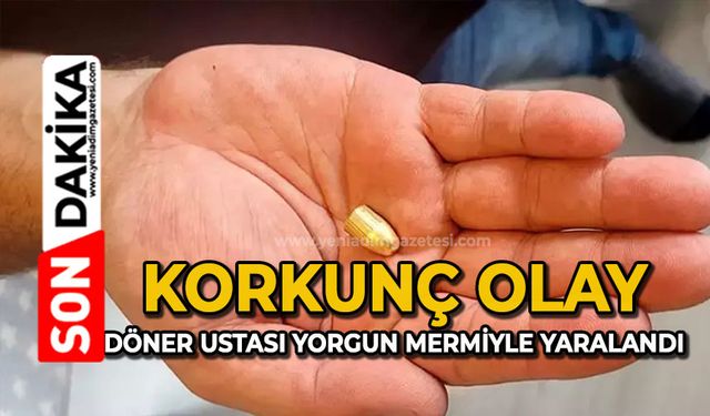 Korkunç olay: Döner ustası yorgun mermiyle yaralandı