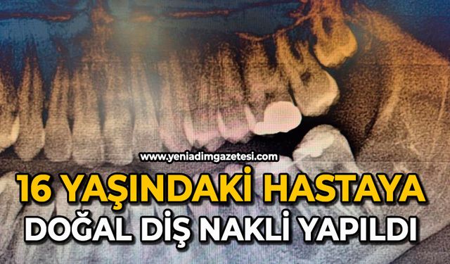 16 yaşındaki hastaya doğal diş nakli yapıldı