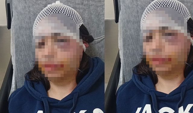 Ayrılık kararını kabullenemeyip kız arkadaşını darp etmişti: 'Pişmanım'