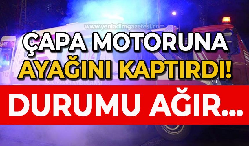 Çapa motoruna ayağına kaptırdı: Durumu ağır!