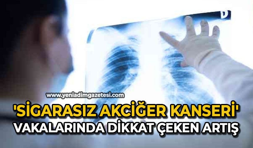 'Sigarasız akciğer kanseri' vakalarında dikkat çeken artış