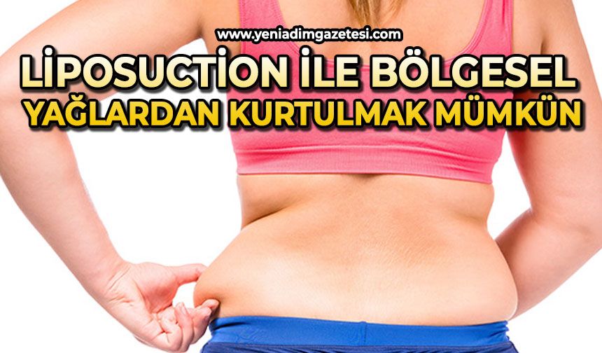 "Liposuction ile bölgesel yağlardan kurtulmak mümkün"