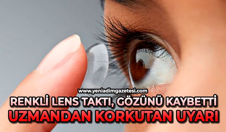 Renkli lens taktı, gözünü kaybetti: Uzmandan korkutan uyarı