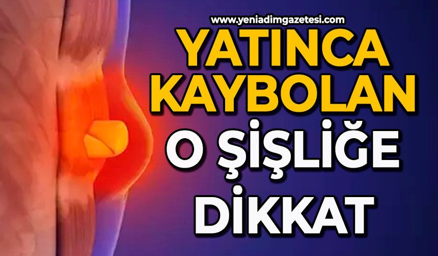 Yatınca kaybolan o şişliğe dikkat