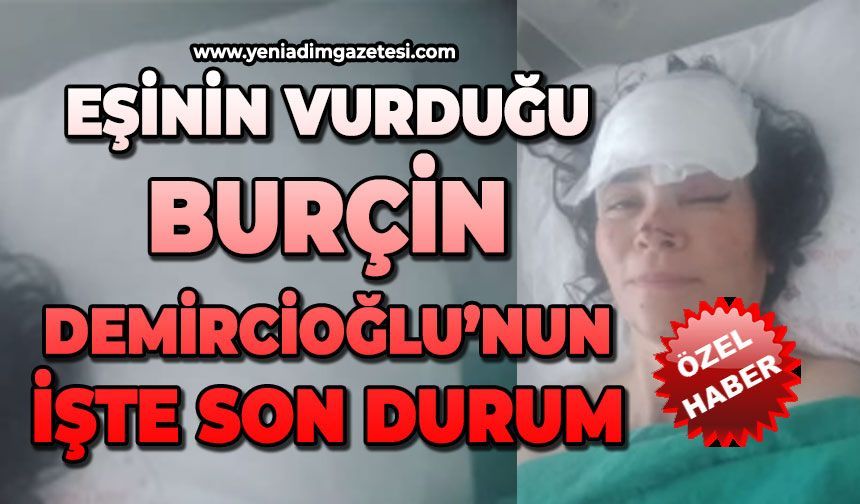 Eşi tarafından vurulan Burçin Demircioğlu’ndan haber var: İşte son durum